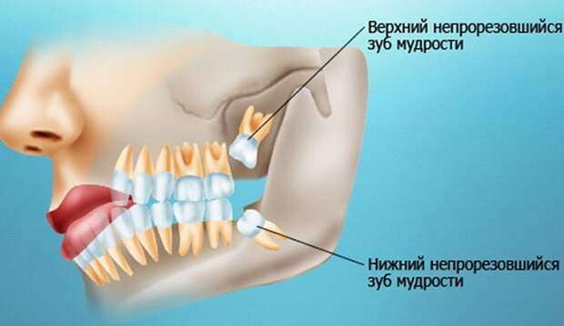 10 эволюционных изменений, которые оставили след на теле человека