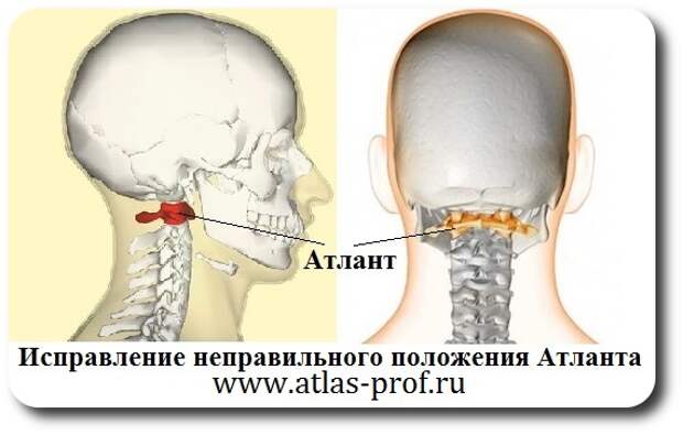атлант это первый шейный позвонок