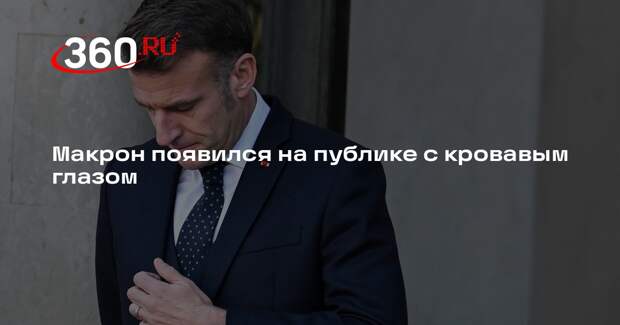 Le Figaro: Макрон вышел на публику с воспаленным красным глазом