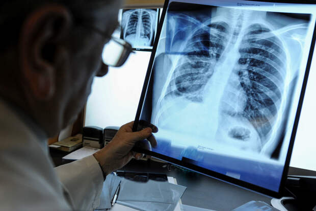 «Не проживают и года» Популярный у россиян метод диагностики не снижает смертность от рака. Почему так происходит и что делать?