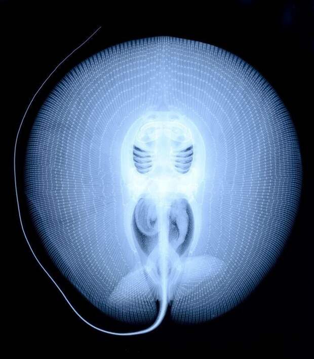 Рентгеновский снимок ската-хвостокола