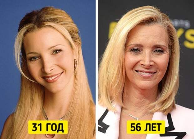 Знаменитые женщины, которые отказались от уколов красоты