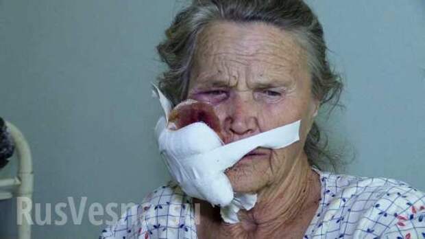 В Донбассе огнём ВСУ ранена 82-летняя женщина (ФОТО) | Русская весна