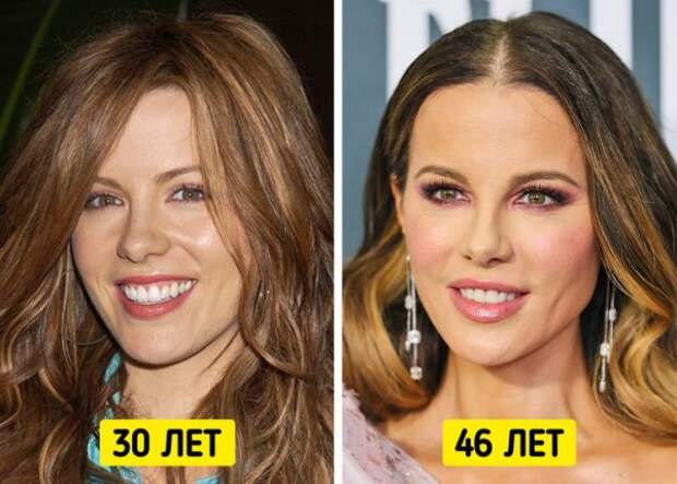 Знаменитые женщины, которые отказались от уколов красоты