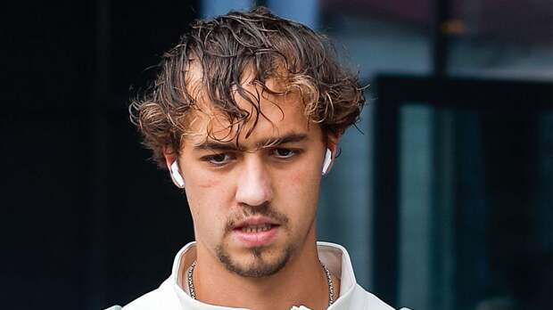 В ЦСКА рассказали о травме Лукина: «Получил достаточно непростое мышечное повреждение»