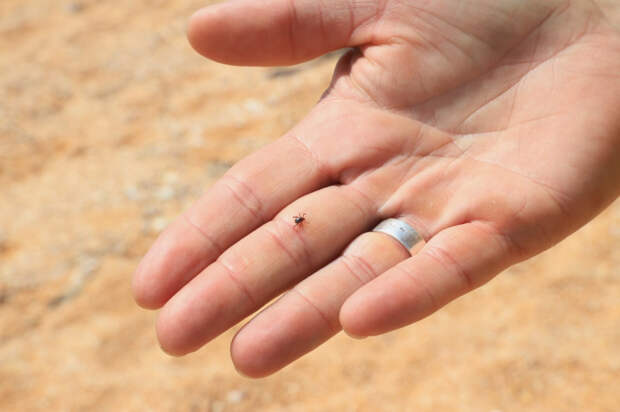 Заливать спиртом и прижигать: врач назвал главные ошибки при удалении клеща