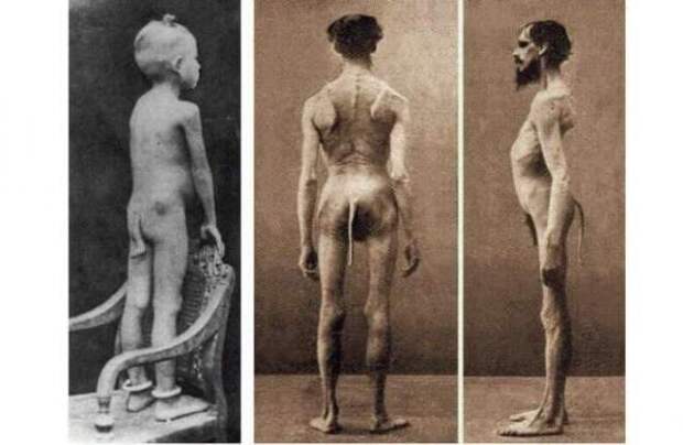 Загадка отрицательного резус-фактора: Инопланетное вмешательство?