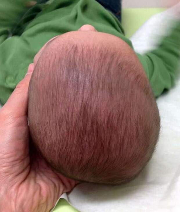 Сигналы для родителей, которые хотят вырастить здоровых детей