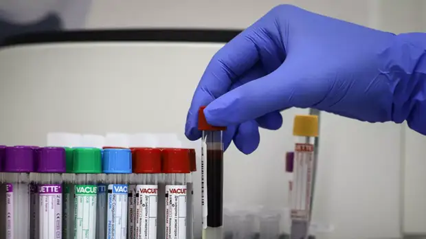 Пульмонолог заявила о нескольких штаммах коронавируса на Украине