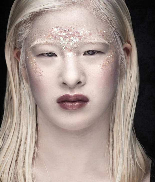 Meet-Chinese-Xueli-Abbing-the-albino-abandoned-when-she-was-a-baby-who-became-a-Vogue-model-6090fb13e06bb-png__700.jpg Meet-Chinese-Xueli-Abbing-the-albino-abandoned-when-she-was-a-baby-who-became-a-Vogue-model-6090fb13e06bb-png__700.jpg