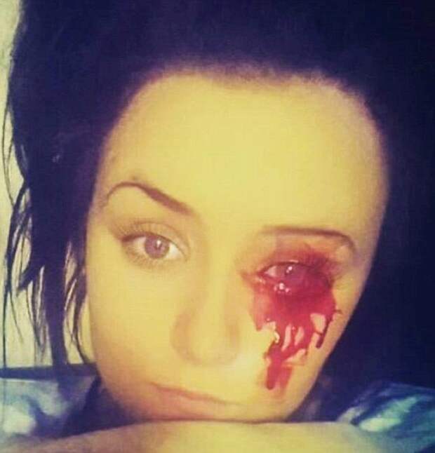 eye