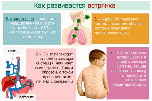 Развитие болезни - этапы