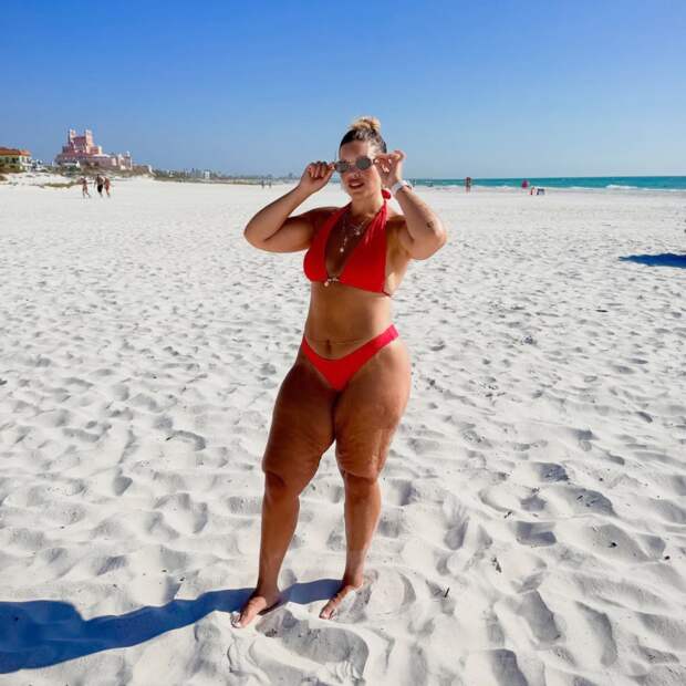 Женщина похудела на 77 килограммов без операций и уколов