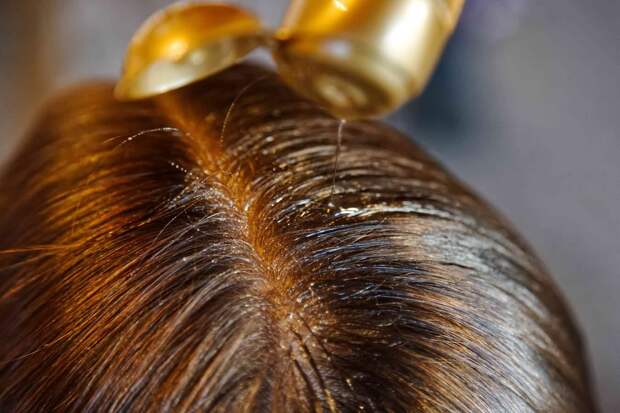 use-oil-nourish-your-hair-naturally-4858483-11-9f47d999c6124e3ba5654329d9