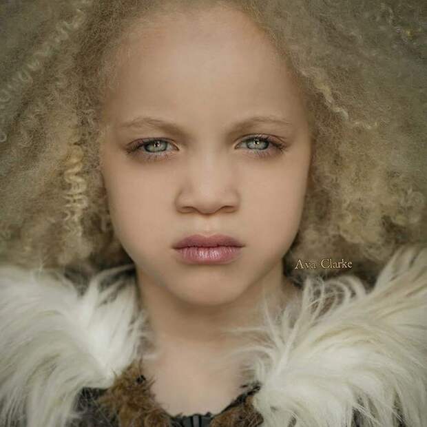 Ава Кларк – 8-летняя девочка-альбинос, ставшая юной афроамериканской моделью Ава Кларк, Ava Clarke, девочка-альбинос ставшая моделью