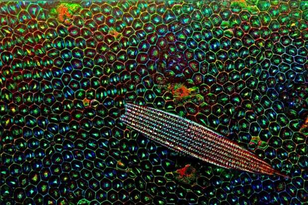 Победители конкурса микрофотогарфии Small World Photomicrography 2016