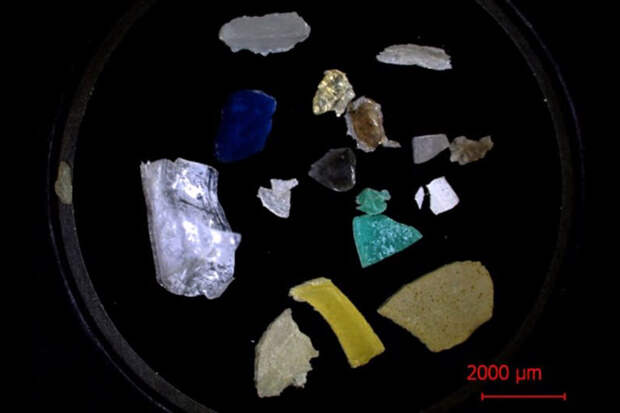 BMC: микропластик из бутылок может вызывать гибель клеток поджелудочной