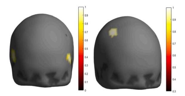 Слева. Активация островковой коры на приятную еду. Справа. Активация правой предцентральной извилины на нейтральную еду