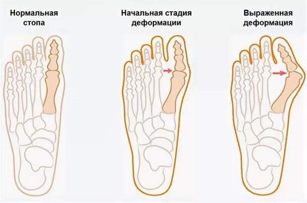 5 причин не покупать дешевую обувь
