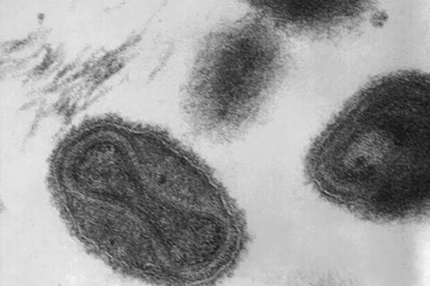 В США предложили дать более толерантное название вирусу оспы обезьян