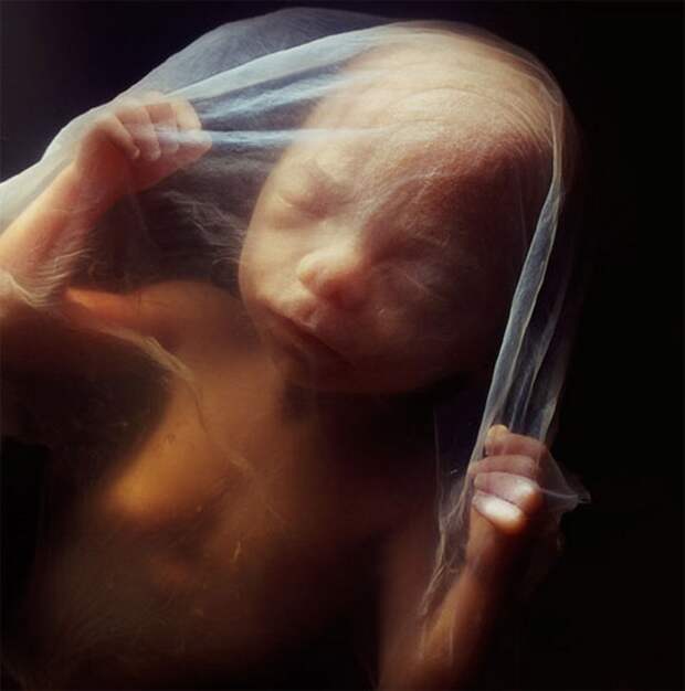 От зачатия до родов: 9 месяцев развития младенца в 19 фотографиях!