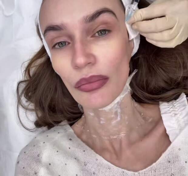 Блогерша Алена Водонаева сделала инъекцию с ДНК лосося