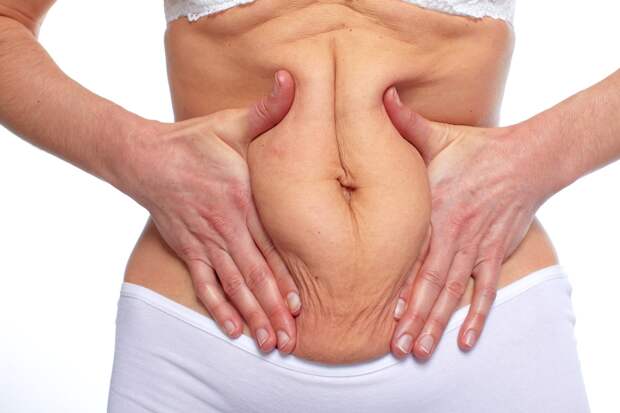 Не диеты, а рекомпозиция: как в 40+ избавиться от дряблости и не обвиснуть