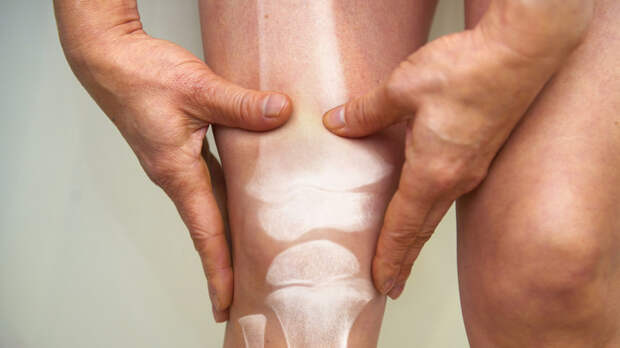 Врач Нечаев: обострение подагры начинается внезапно