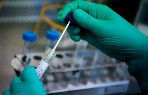 На Кубани выявили 87 случаев заражения коронавирусом