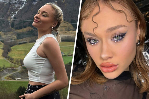 Жизнь в Норвегии оказалась дорогой для избитой в Дубае украинской OnlyFans-модели