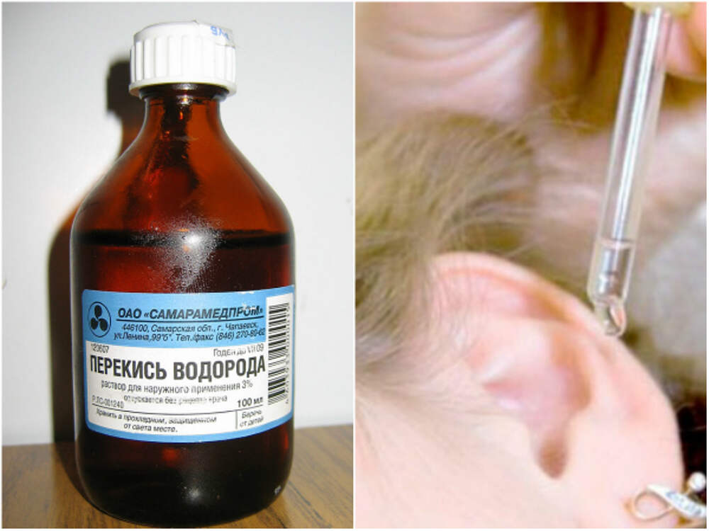 Почистить уши перекисью водорода в домашних условиях. Пероксид водорода для ушей. Перекисьводоророда в ухо. Водорода пероксид капли в уши.