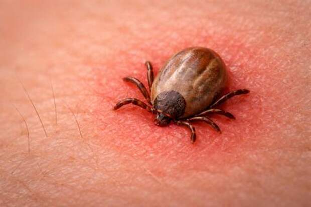 Красный флаг для мяса: как укус клеща запускает смертельную аллергию