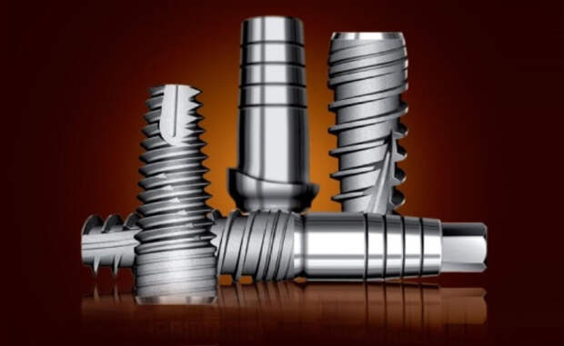 Плюсы процедуры имплантации зубов «под ключ»