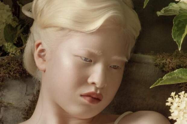 Meet-Chinese-Xueli-Abbing-the-albino-abandoned-when-she-was-a-baby-who-became-a-Vogue-model-6090f7923c9d4__700.jpg