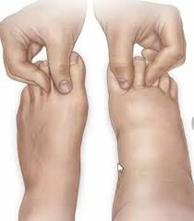 Ударно-волновая терапия (УВТ) при лечении лимфостаза