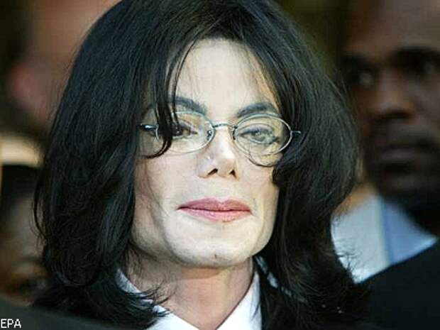 Медики пояснили, отчего так резко поменялась внешность Майкла Джексона