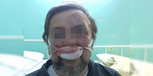 Пермского пенсионера избили из-за снега, попавшего на иномарку