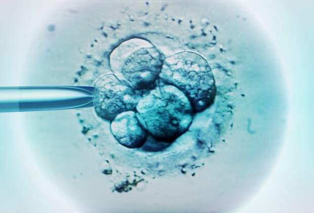 Ученые изучают эмбрионы, чтобы понять болезни развития
