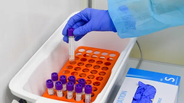 В Самарской области выявили 1785 случаев COVID-19 за сутки