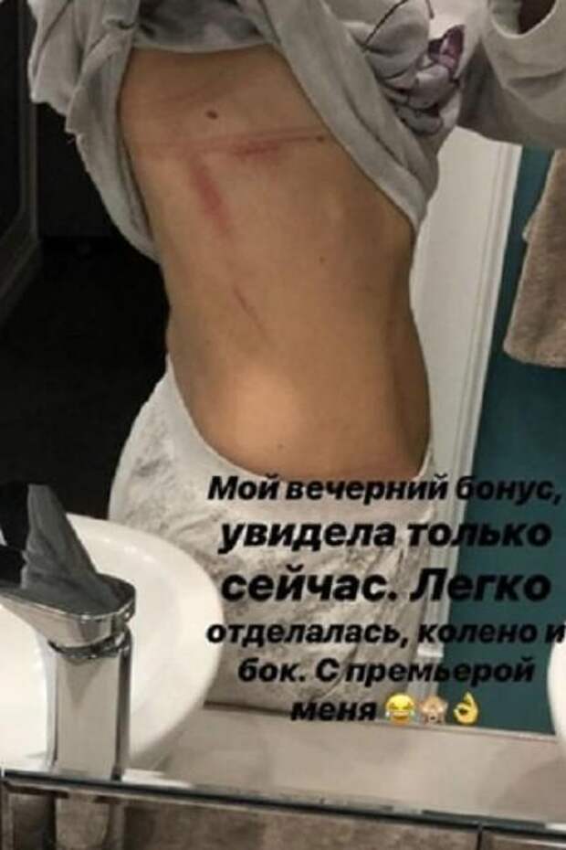 Травмы оказались болезненными Травмы оказались болезненными