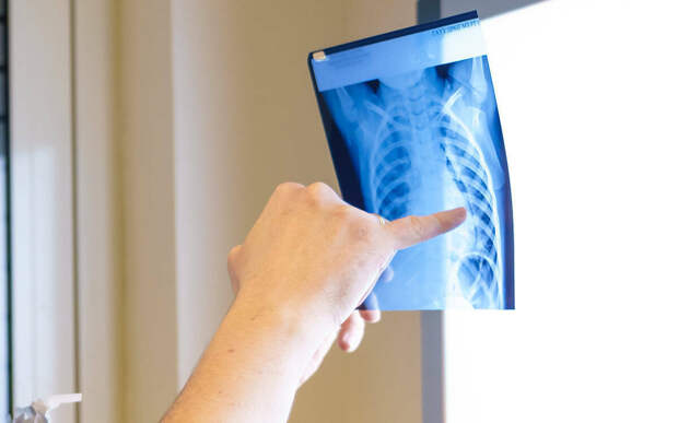 Четверть болеющих детей – из семей мигрантов: какова ситуация с туберкулезом в Татарстане