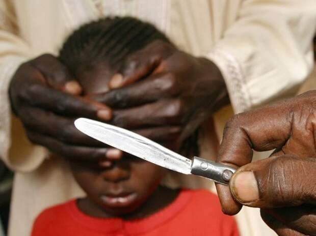 Кошмар женского обрезания: сбежавшая в Россию нигерийка рассказала о процедуре
