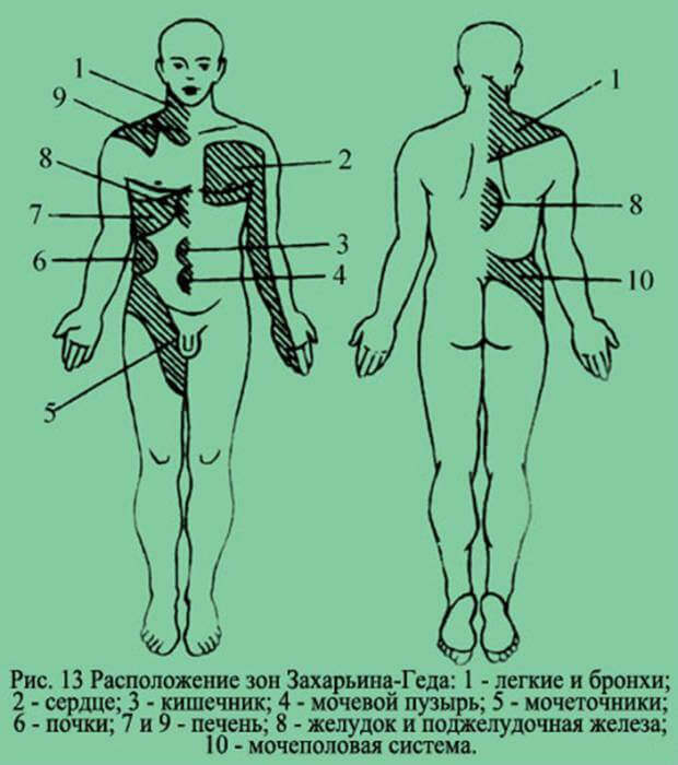 Зоны захарьина геда на стопе схема