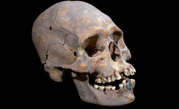 В мексиканской пирамиде нашли череп с нефритовыми зубными протезами