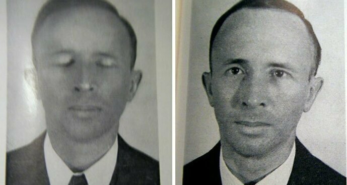 Стоило ли оно того: исторические снимки результатов лоботомии Стоило ли оно того: исторические снимки результатов лоботомии