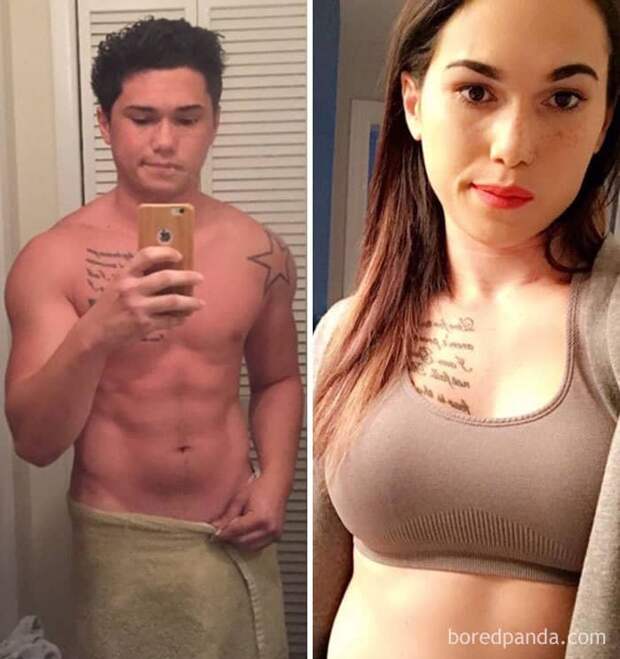 22-Year-Old, 1 Year And 3 Months On HRT