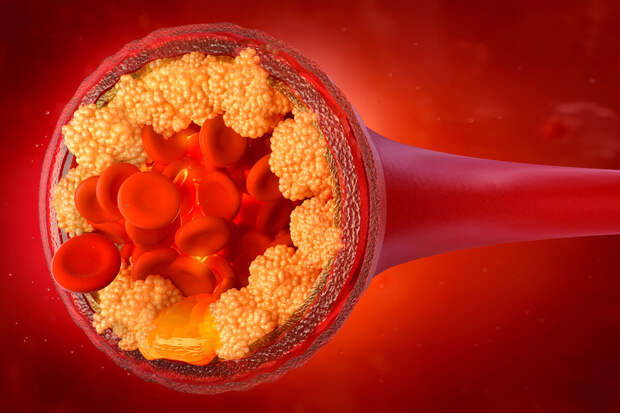 Nature Medicine: испытан препарат, избирательно снижающий уровень триглицеридов