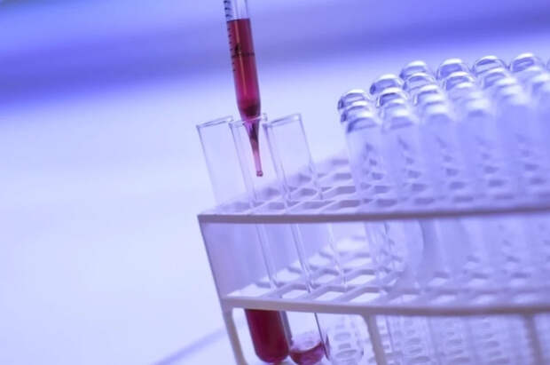 Эксперт назвала медицинские тесты с сомнительной эффективностью
