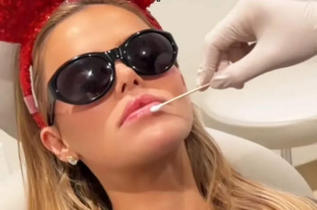 Известная модель сообщила об удалении филлера из губ фразой «подарок маме и папе»