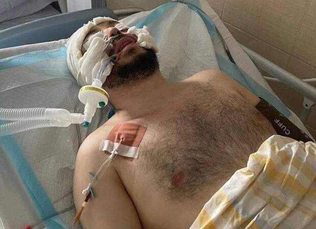 Мужчина впал в кому после избиения в ТЦК в Днепропетровске